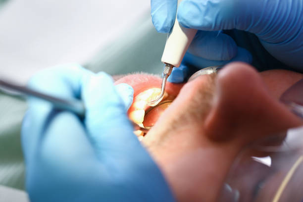 Urgent Tooth Repair in VT