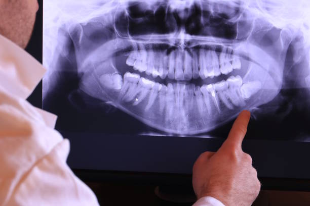 Dentist for Dental Trauma in VT