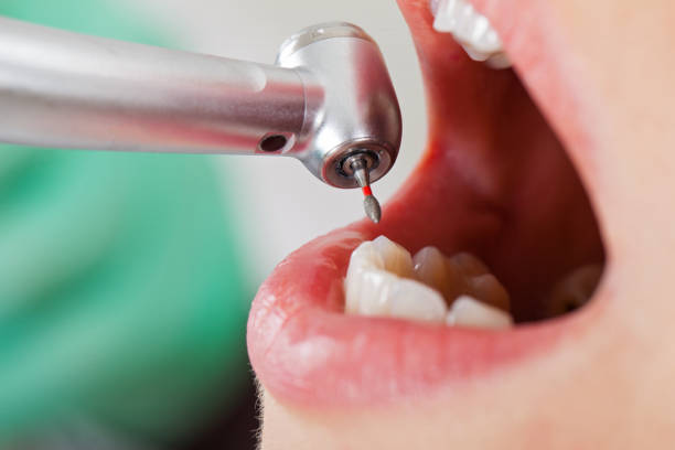 Best Emergency Gum Pain Relief  in Manchester Center, VT